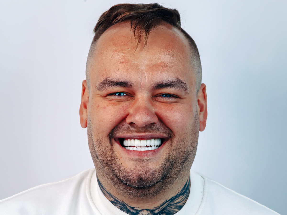 Smile after E-max veneers · Smile makeover — patient Kamil from Poland